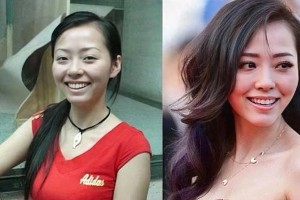 明星整容失败案例：张靓颖、郑爽等颜值变化大